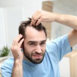 Що ефективніше під час лікування облисіння: міноксидил чи финастерид